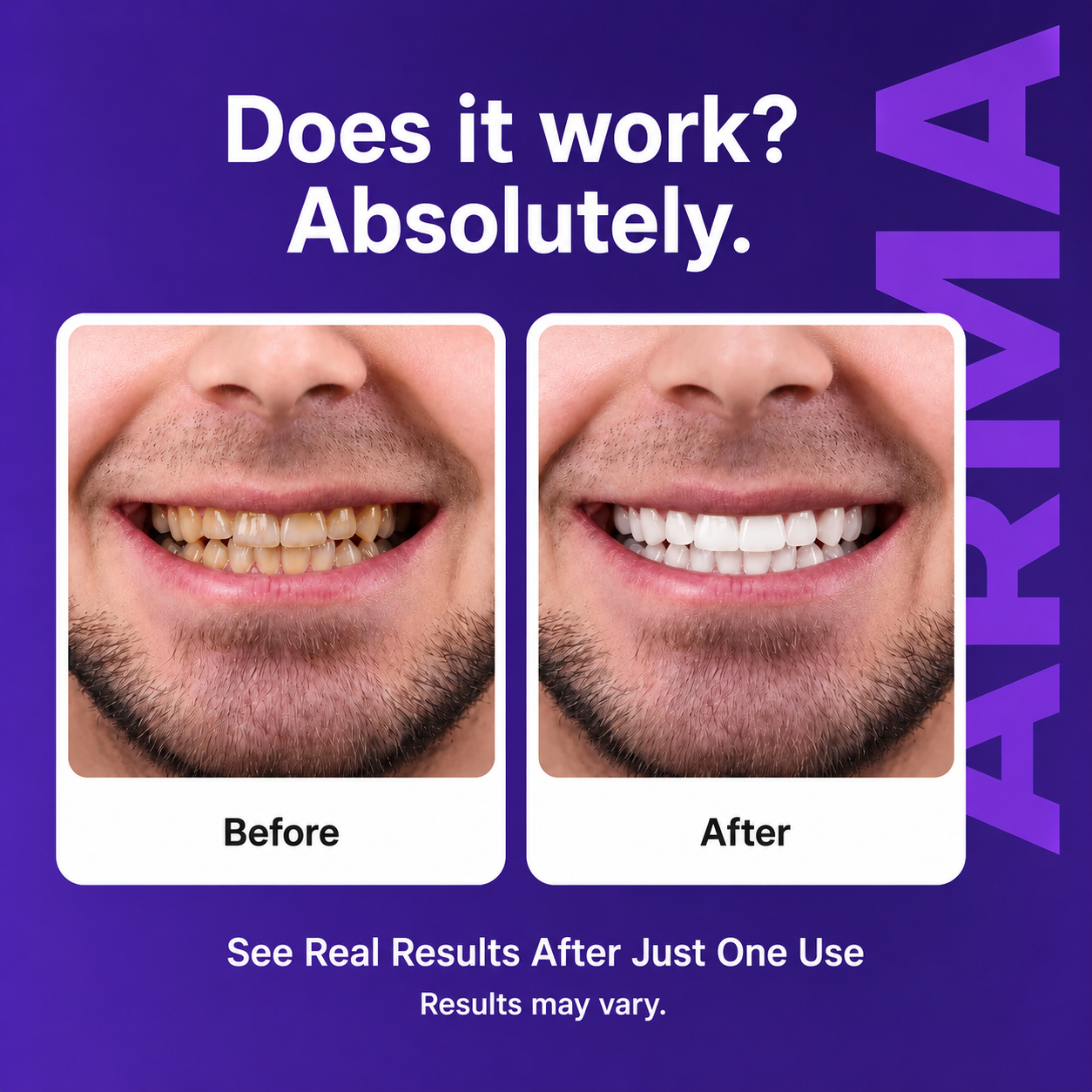 ARMA Purple Teeth Whitening Strips™