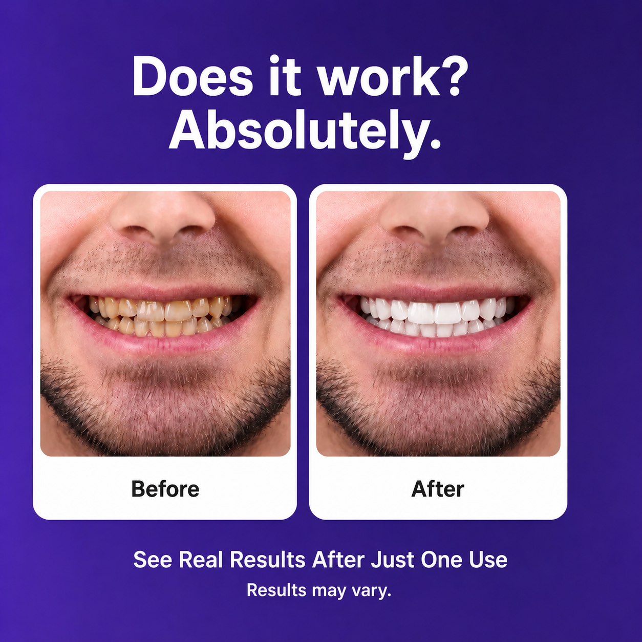 ARMA Purple Teeth Whitening Strips™
