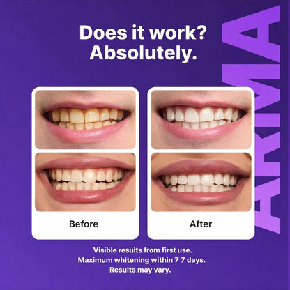 ARMA Purple Teeth Whitening Strips™