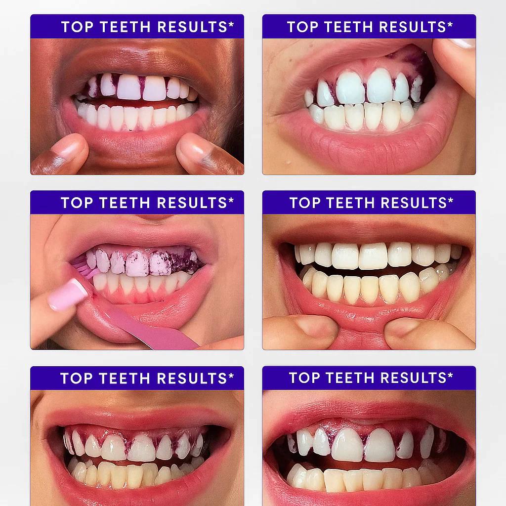 ARMA Purple Teeth Whitening Strips™