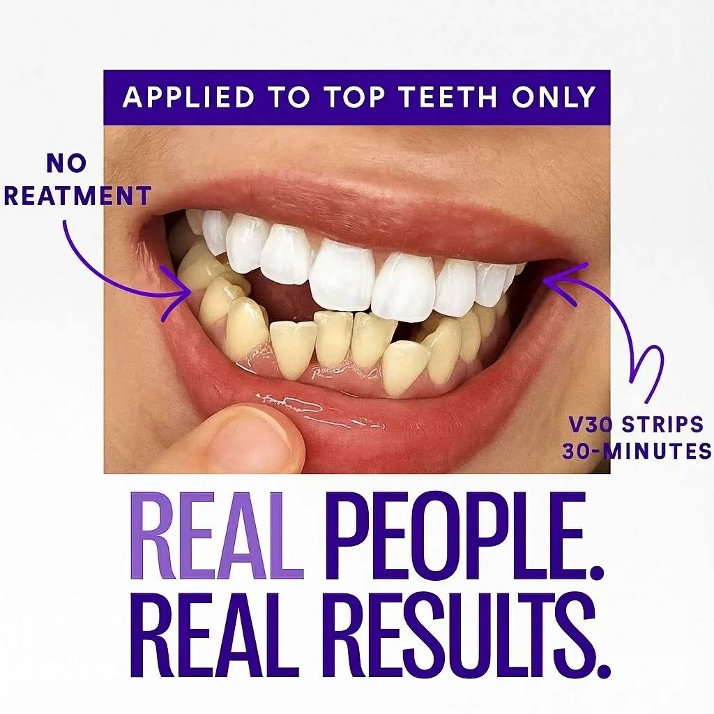 ARMA Purple Teeth Whitening Strips™
